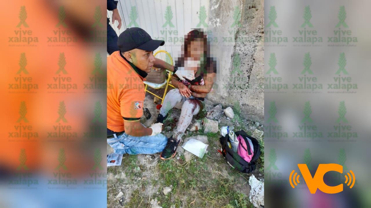 Intenta matar a su pareja en Xalapa. Intenta matar a su pareja en Xalapa.