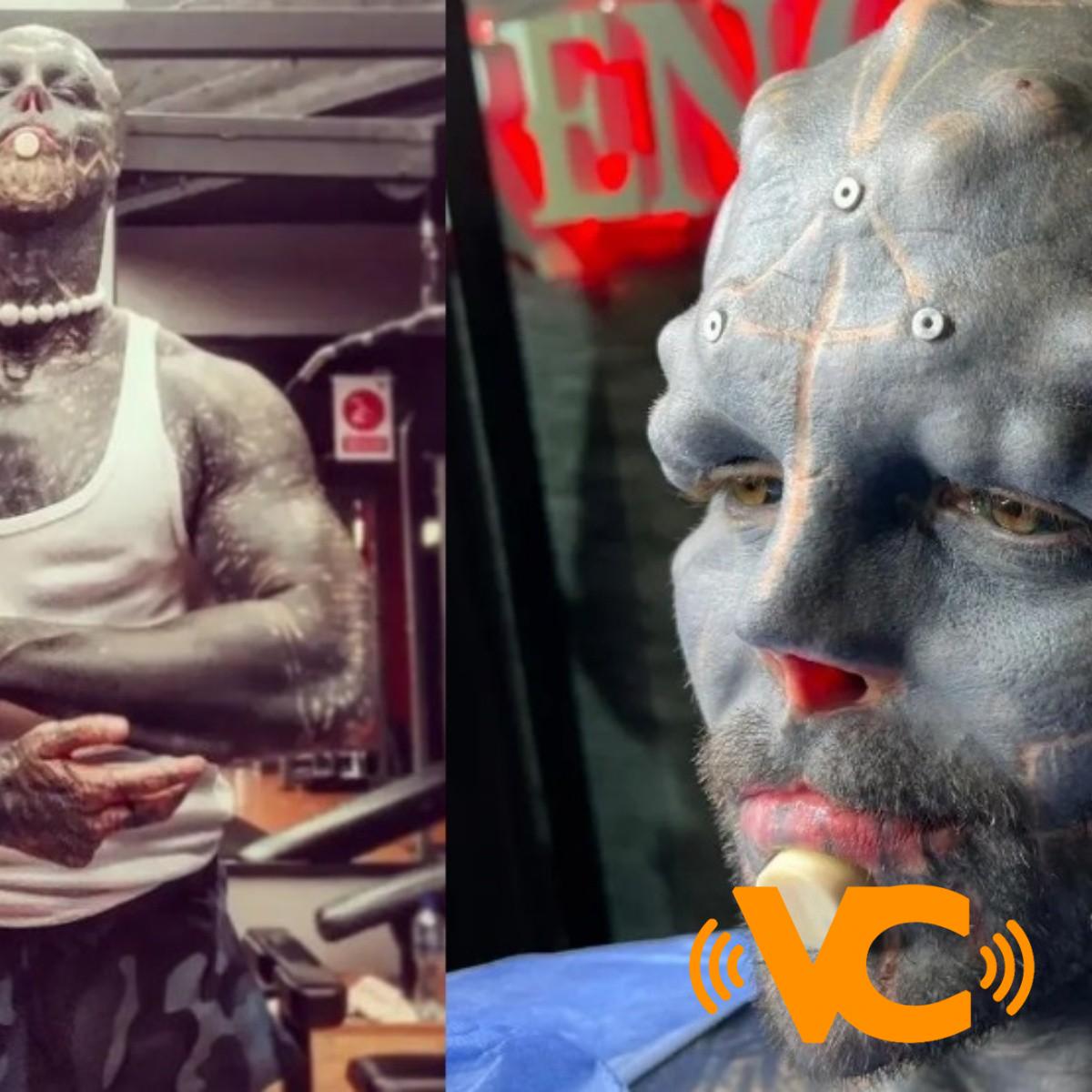 Hombre quiere convertirse en alien y se amputará una pierna para seguir con su transformación Hombre quiere convertirse en alien y se amputará una pierna para seguir con su transformación
