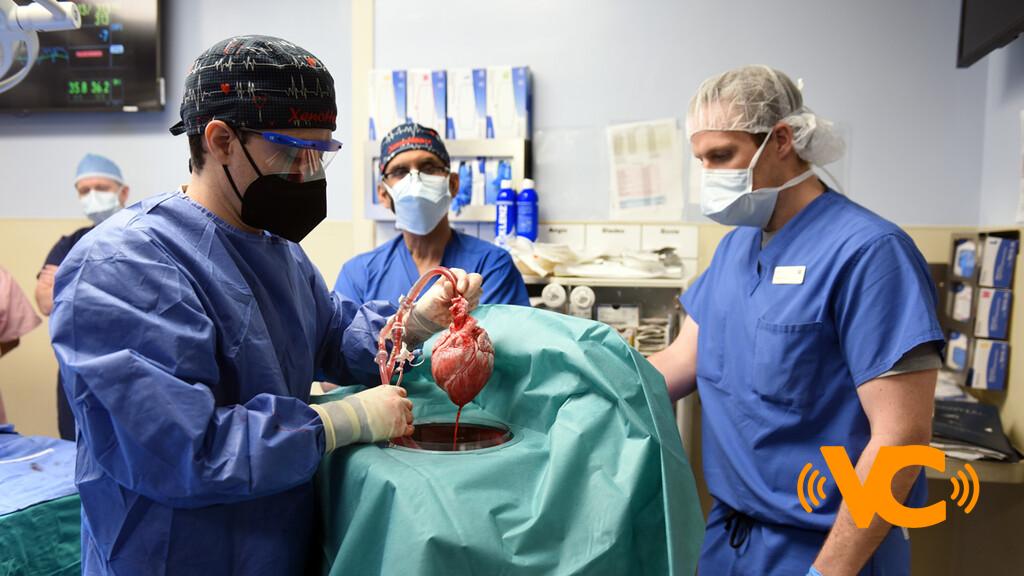 El corazón de cerdo que recibió un hombre tenía un virus porcino, y pudo ser un factor para reducir la vida del paciente, según informe El corazón de cerdo que recibió un hombre tenía un virus porcino, y pudo ser un factor para reducir la vida del paciente, según informe