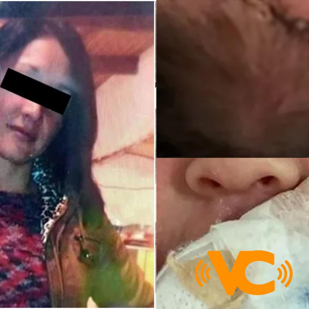 Bebé cae de cabeza al salir del vientre de su mamá y necesitó sutura Bebé cae de cabeza al salir del vientre de su mamá y necesitó sutura