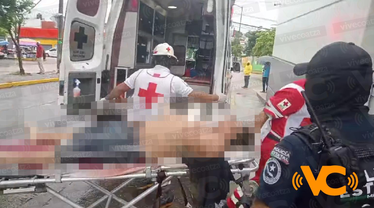 Le «mochan» las manos para luego balearlo, en Coatzacoalcos; lesionado revela que su agresores le dijeron que lo hicieron «por andar robando» Le «mochan» las manos para luego balearlo, en Coatzacoalcos; lesionado revela que su agresores le dijeron que lo hicieron «por andar robando»