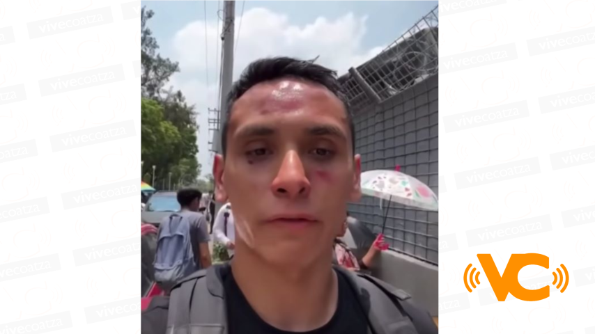 Joven fue golpeado por 5 personas presuntamente revendedores en el palacio de los deportes Joven fue golpeado por 5 personas presuntamente revendedores en el palacio de los deportes