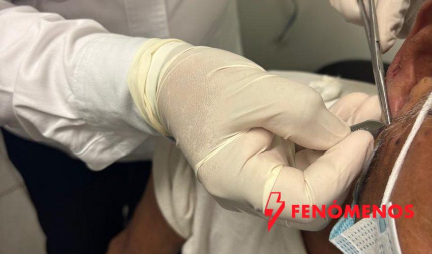 Realiza SST jornada dermatológica para detección de lepra