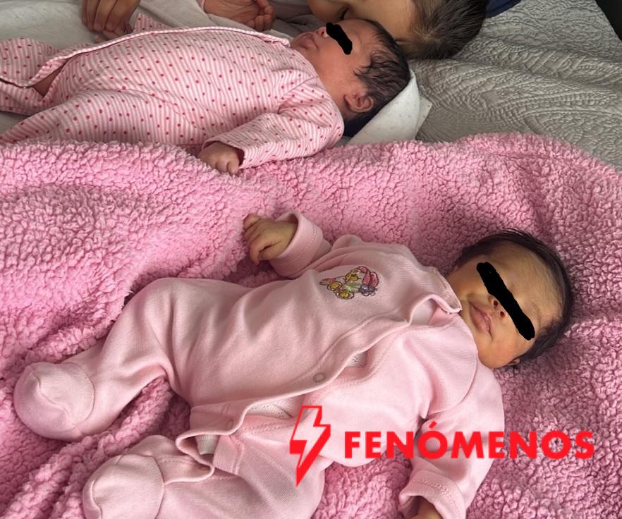 SSG brinda atención especializada a hermanas recién nacidas con 33 semanas de gestación.